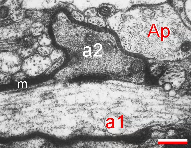 Ideal-resolution EM example of an axo-axonic synapse with clearly visible partners