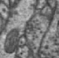 Real MEC data at coordinates 166201, 133723, 5472 showing an axo-axonic synapse at working resolution